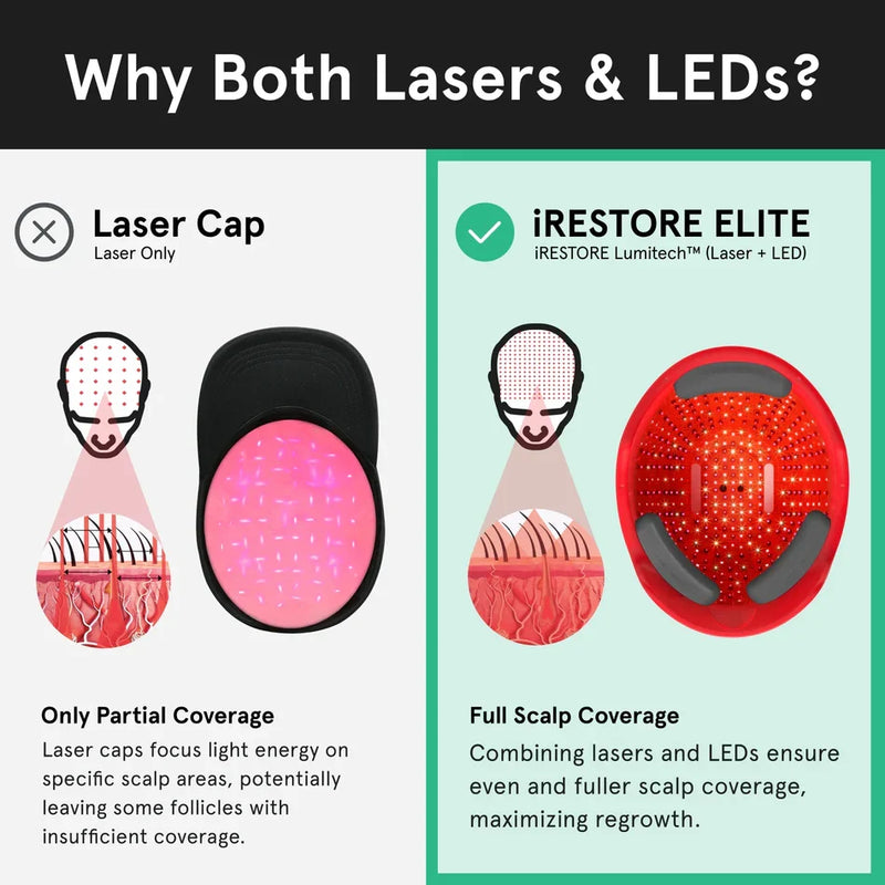 iRestore Elite Laser Hair Growth System