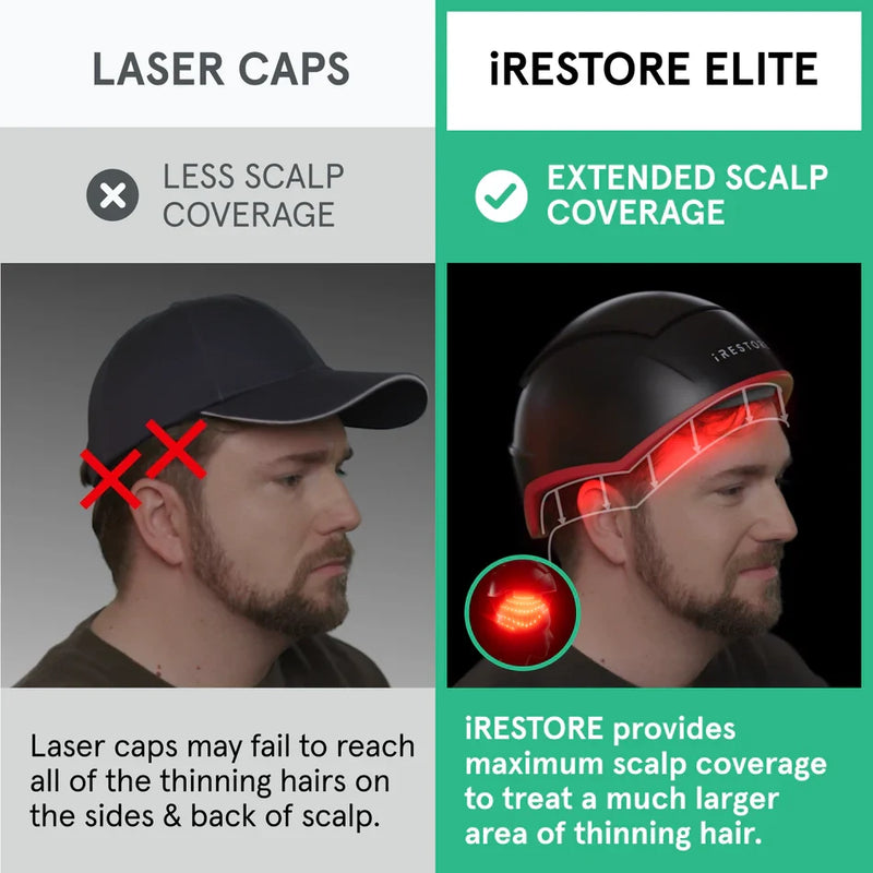 iRestore Elite Laser Hair Growth System